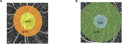 The Relationship Between Nailfold Microcirculation and Retinal Microcirculation in Healthy Subjects